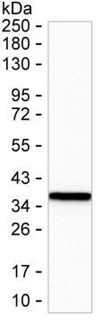 ANXA3